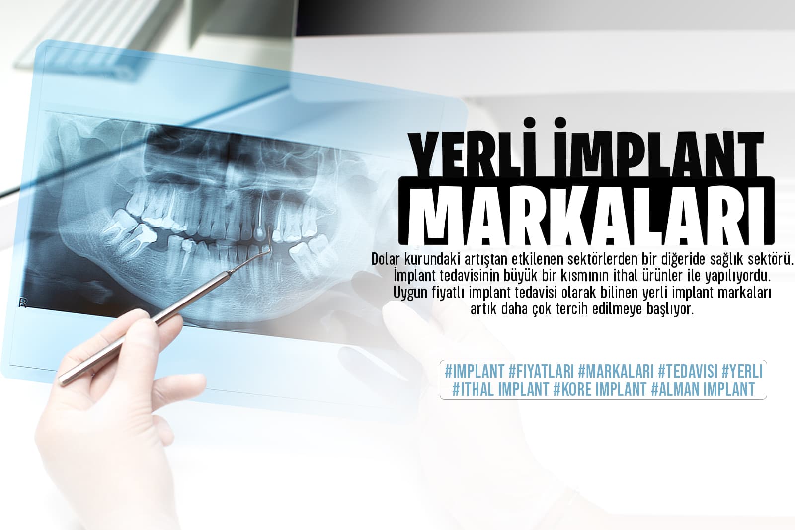 Yerli İmplant Markaları